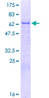 ab160843 on a 12.5% SDS-PAGE stained with Coomassie Blue.