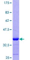 ab160844 on a 12.5% SDS-PAGE stained with Coomassie Blue.