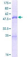 ab163227 on a 12.5% SDS-PAGE stained with Coomassie Blue.