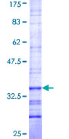 ab163228 on a 12.5% SDS-PAGE stained with Coomassie Blue.