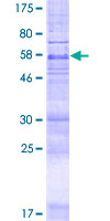 ab165676 on a 12.5% SDS-PAGE stained with Coomassie Blue.