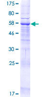 ab165316 on a 12.5% SDS-PAGE stained with Coomassie Blue.