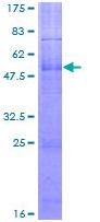 12.5% SDS-PAGE analysis of ab152516 stained with Coomassie Blue.