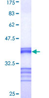 ab153148 on a 12.5% SDS-PAGE stained with Coomassie Blue.