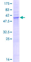 ab164888 on a 12.5% SDS-PAGE stained with Coomassie Blue.