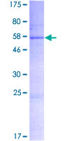 ab165555 on a 12.5% SDS-PAGE stained with Coomassie Blue.