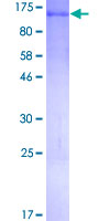 ab158865 on a 12.5% SDS-PAGE stained with Coomassie Blue.