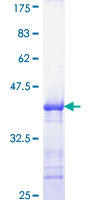 ab158866 on a 12.5% SDS-PAGE stained with Coomassie Blue.