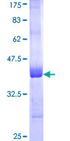 ab163431 on a 12.5% SDS-PAGE stained with Coomassie Blue.