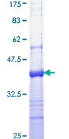 ab163470 on a 12.5% SDS-PAGE stained with Coomassie Blue.