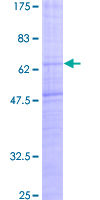 ab158564 on a 12.5% SDS-PAGE stained with Coomassie Blue.
