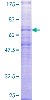 ab158565 on a 12.5% SDS-PAGE stained with Coomassie Blue.