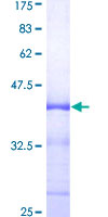 ab158566 on a 12.5% SDS-PAGE stained with Coomassie Blue.
