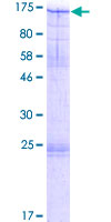 ab153397 on a 12.5% SDS-PAGE stained with Coomassie Blue.
