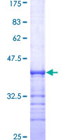 ab158211 on a 12.5% SDS-PAGE stained with Coomassie Blue.