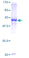 ab163218 on a 12.5% SDS-PAGE stained with Coomassie Blue.