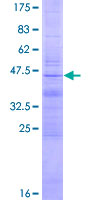 ab160494 on a 12.5% SDS-PAGE stained with Coomassie Blue.