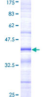 ab160495 on a 12.5% SDS-PAGE stained with Coomassie Blue.