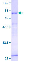 ab163253 on a 12.5% SDS-PAGE stained with Coomassie Blue.