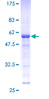 ab158874 on a 12.5% SDS-PAGE stained with Coomassie Blue.