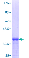 ab158875 on a 12.5% SDS-PAGE stained with Coomassie Blue.