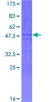 ab165919 on a 12.5% SDS-PAGE stained with Coomassie Blue.