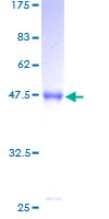 ab164823 on a 12.5% SDS-PAGE stained with Coomassie Blue.
