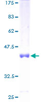 ab162385 on a 12.5% SDS-PAGE stained with Coomassie Blue.