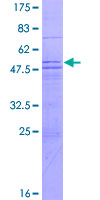 ab164990 on a 12.5% SDS-PAGE stained with Coomassie Blue.