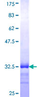 ab164991 on a 12.5% SDS-PAGE stained with Coomassie Blue.