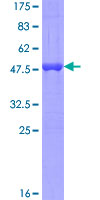 ab162958 on a 12.5% SDS-PAGE stained with Coomassie Blue.