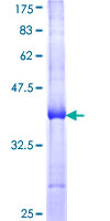 ab158876 on a 12.5% SDS-PAGE stained with Coomassie Blue.