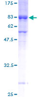 ab163427 on a 12.5% SDS-PAGE stained with Coomassie Blue.