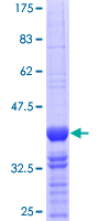 ab163428 on a 12.5% SDS-PAGE stained with Coomassie Blue.