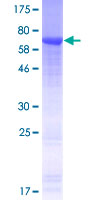 ab166519 on a 12.5% SDS-PAGE stained with Coomassie Blue.