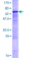 ab159495 on a 12.5% SDS-PAGE stained with Coomassie Blue.