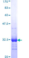 ab159496 on a 12.5% SDS-PAGE stained with Coomassie Blue.