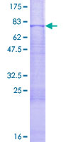 ab159222 on a 12.5% SDS-PAGE stained with Coomassie Blue.
