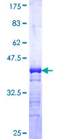 ab159223 on a 12.5% SDS-PAGE stained with Coomassie Blue.