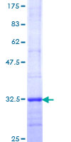 ab114688 analysed on a 12.5% SDS-PAGE gel stained with Coomassie Blue.