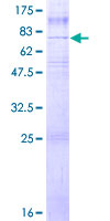 ab160401 on a 12.5% SDS-PAGE stained with Coomassie Blue.