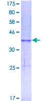 ab153020 on a 12.5% SDS-PAGE stained with Coomassie Blue.