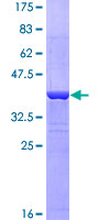 ab153063 on a 12.5% SDS-PAGE stained with Coomassie Blue.