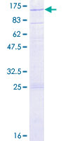 ab158587 on a 12.5% SDS-PAGE stained with Coomassie Blue.