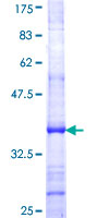 ab158588 on a 12.5% SDS-PAGE stained with Coomassie Blue.