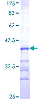 ab158589 on a 12.5% SDS-PAGE stained with Coomassie Blue.
