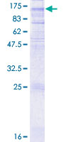 ab158591 on a 12.5% SDS-PAGE stained with Coomassie Blue.