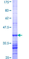 ab158592 on a 12.5% SDS-PAGE stained with Coomassie Blue.