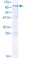 ab163377 on a 12.5% SDS-PAGE stained with Coomassie Blue.