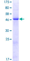 ab162213 on a 12.5% SDS-PAGE stained with Coomassie Blue.